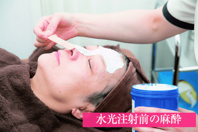 水光注射前の麻酔